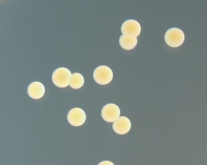 carotenoid pigment staphyloxanthin of Staphylococcus aureus